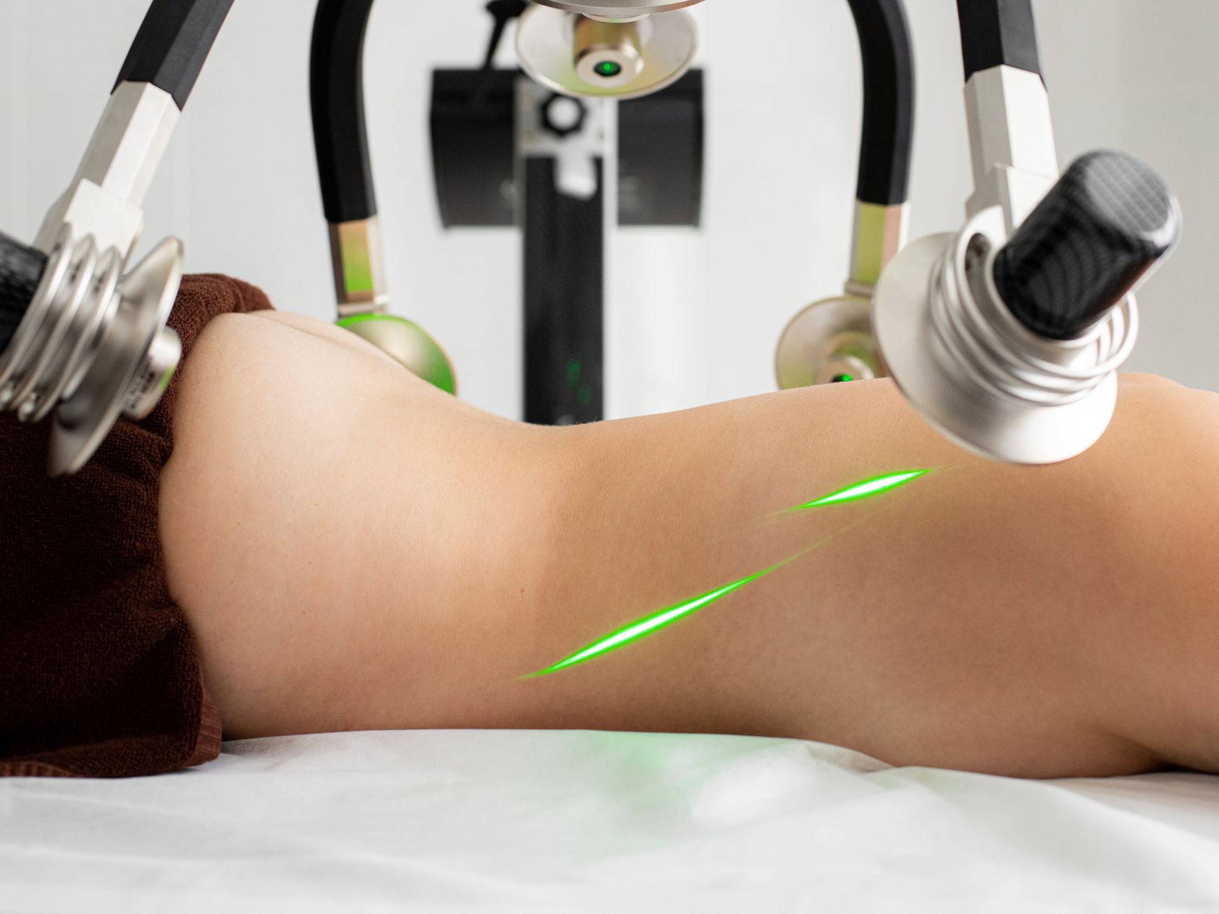laser hair removal guide — Luxury Lashes Federal Way WA