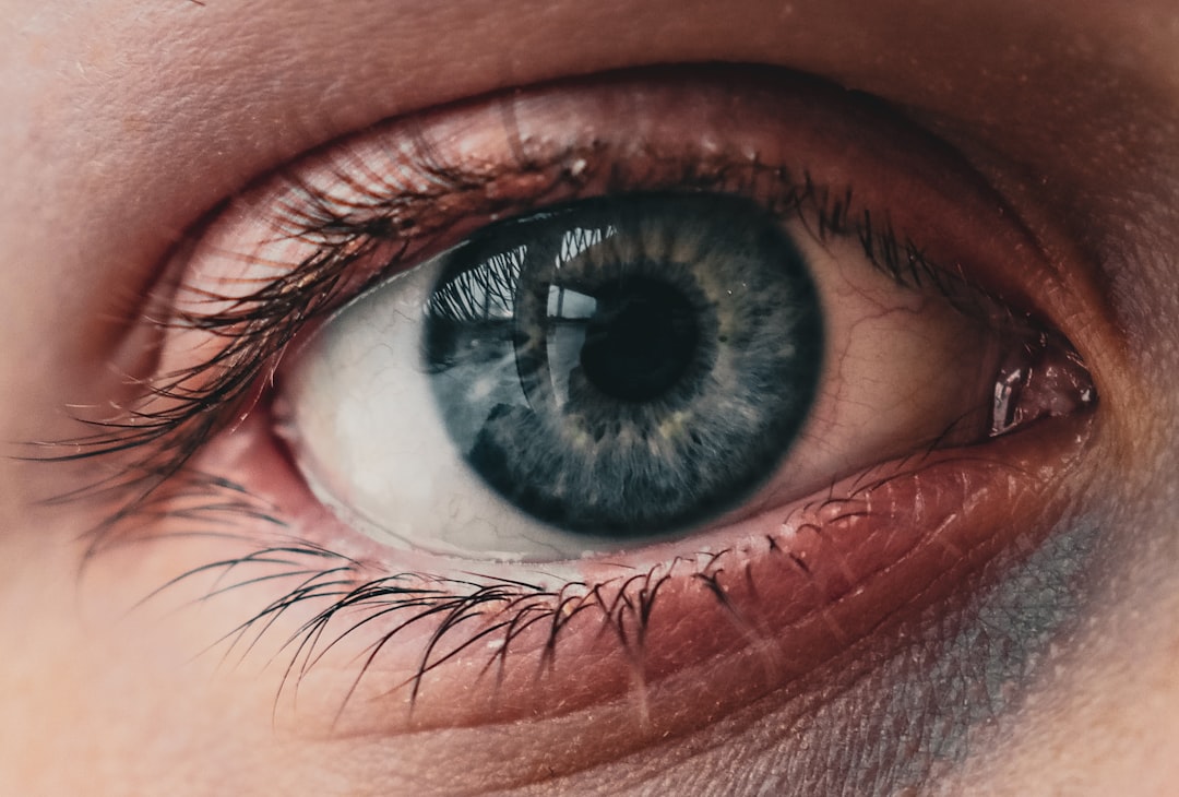Eyelash Extension Allergic Reaction: Signs & What to Do