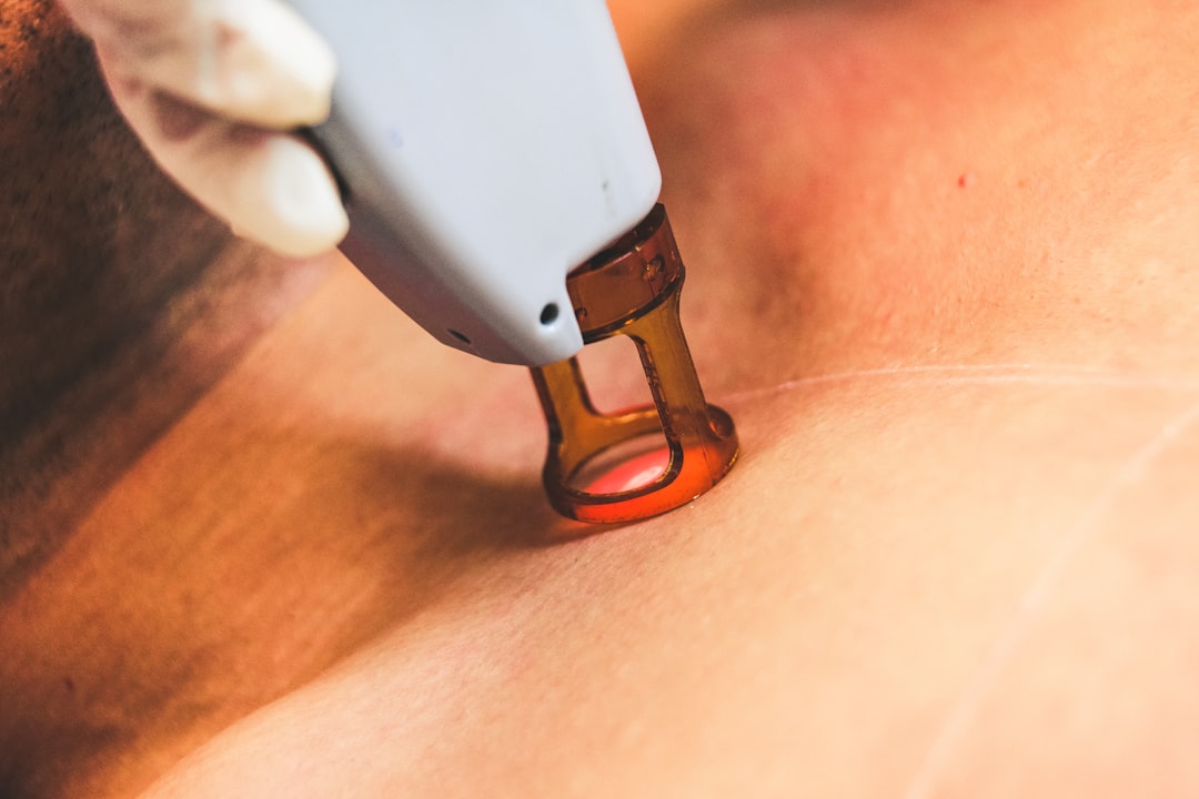 laser hair removal safety closeup — Luxury Lashes Federal Way WA