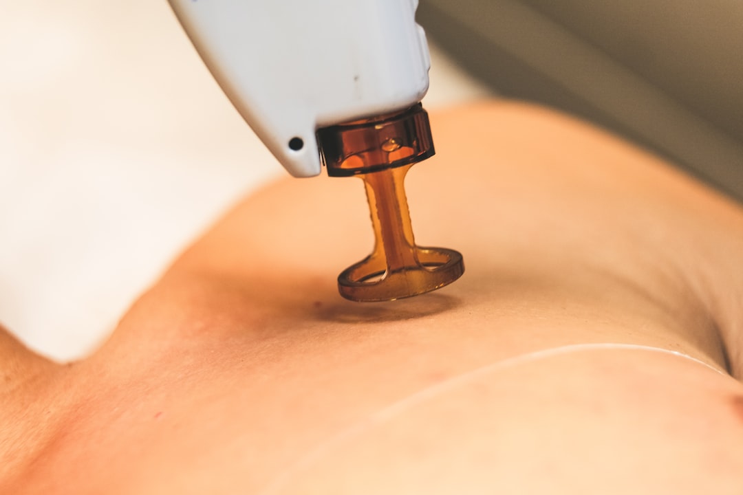 laser hair removal safety guide — Luxury Lashes Federal Way WA