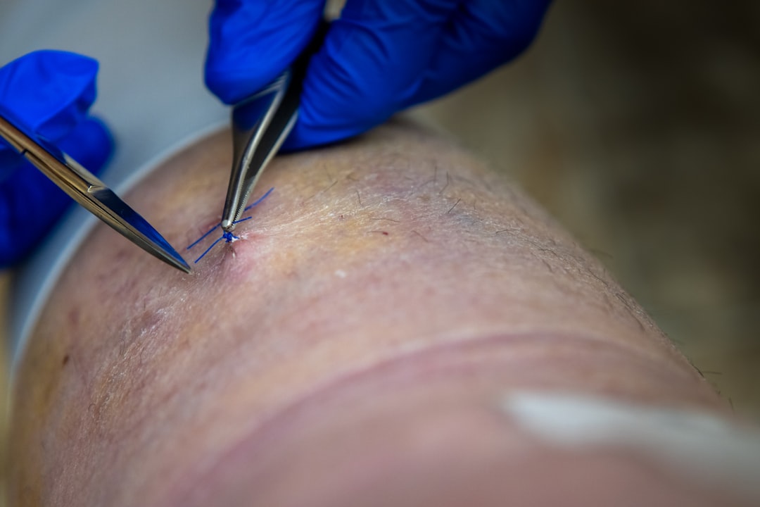 laser hair removal example — Luxury Lashes Federal Way WA