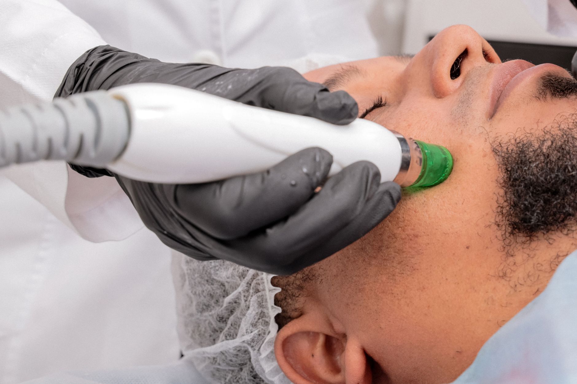 microdermabrasion facial detail — Luxury Lashes Federal Way WA