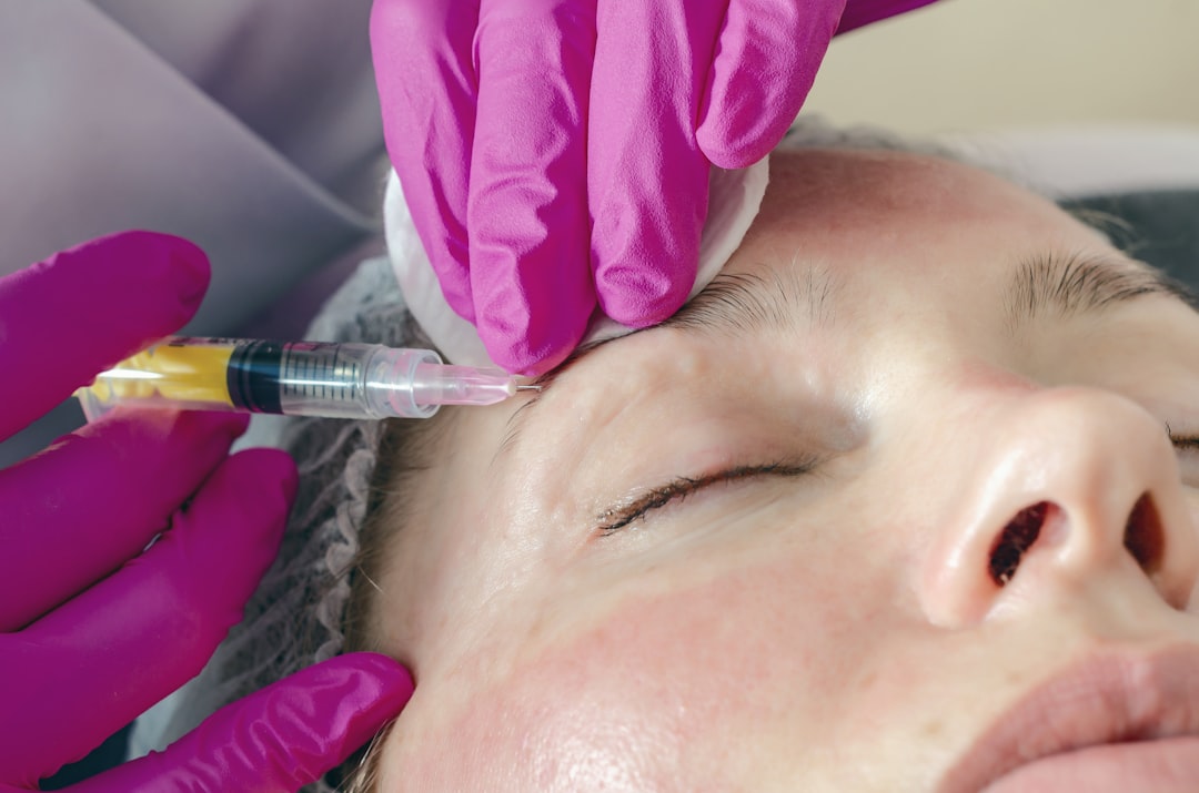 What Is Microneedling? Benefits, Results & Safety — Luxury Lashes Federal Way WA